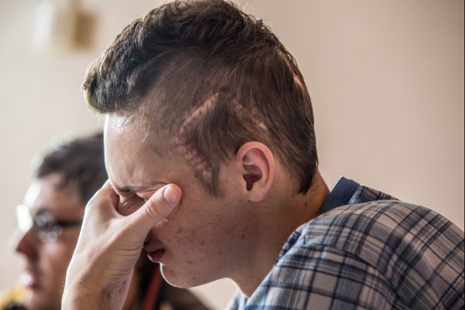 O garoto irá precisar colocar mais extensores dentro da artéria cerebral para diminuir os riscos de um novo problema vascular |