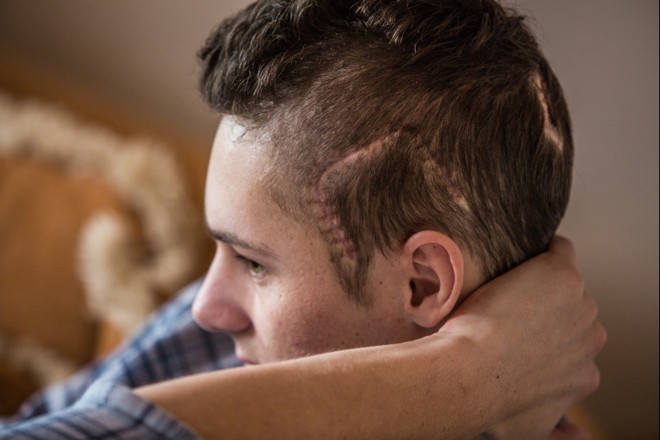 Maicon descobriu uma má formação na artéria cerebral após o AVC |