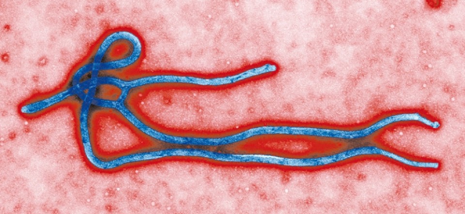 O ebola, que pode ter surgido da divisão de outros vírus há 20 milhões de anos | Centers for Disease Control, via Associated Press