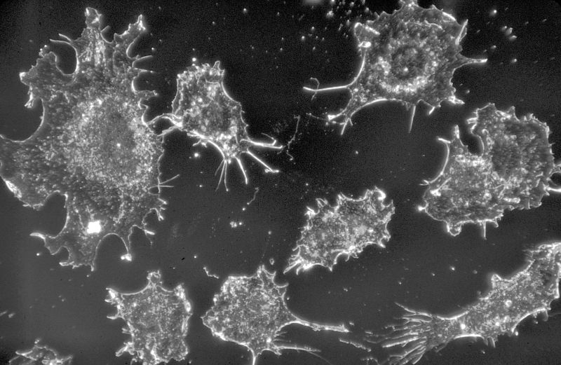 Células cancerígenas vistas no microscópio: novo método deve facilitar diagnóstico | Cecil Fox/National Cancer Institute