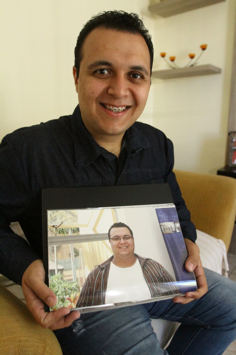 Vanderson mostra a foto de como era antes da cirurgia | Gilberto Abelha/Gazeta do Povo