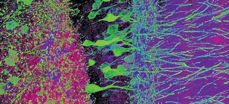 Com a técnica chamada microscopia de expansão, os cientistas podem enxergar melhor neurônios do cérebro de um rato | Ed Boyden, Fei Chen, Paul Tillberg/Massachusetts institute of Technology