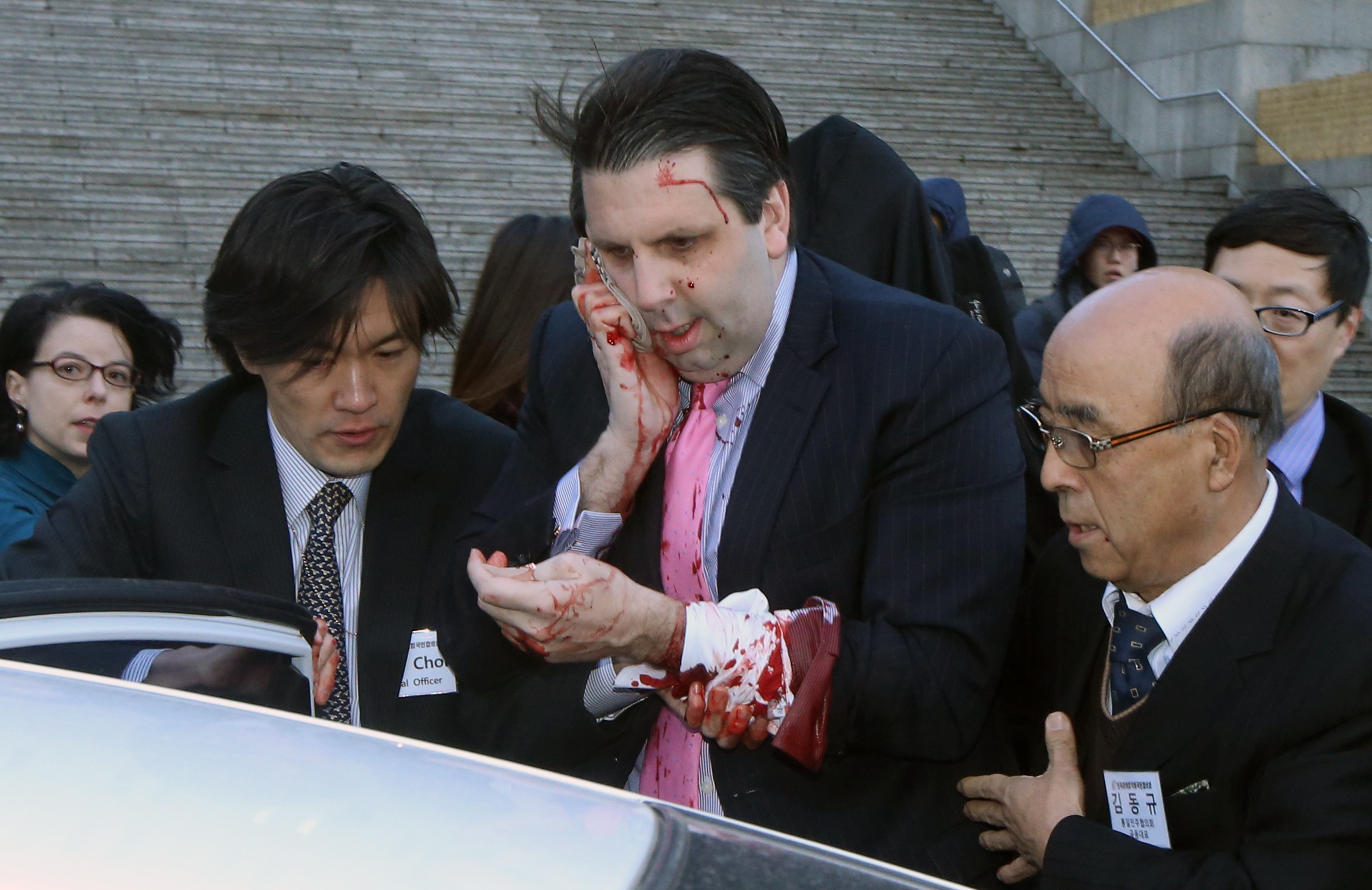 Mark Lippert é atendido após ser atacado em Seul | Yonhap/Reuters