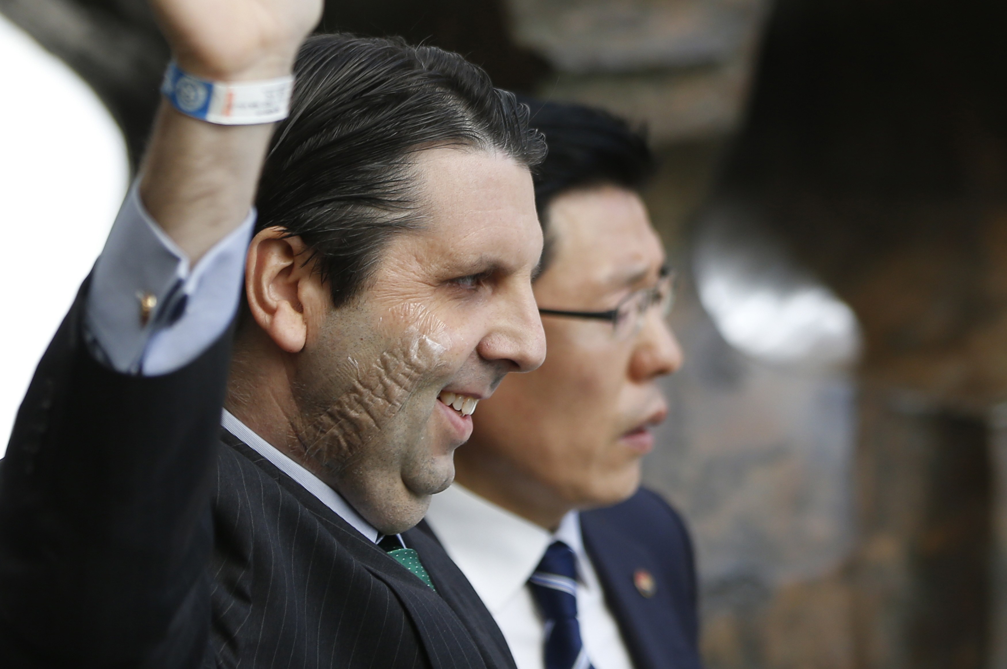 Mark Lippert acena na saída do hospital | Kim Hong-Ji/Reuters