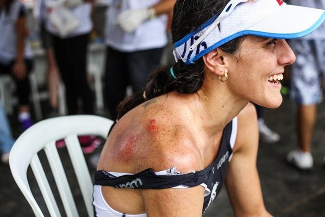 A campeã Caroline Pereira mostra as escoriações causadas pela queda que ela sofreu depois de atropelar o cachorro. | Daniel Castellano/Gazeta do Povo