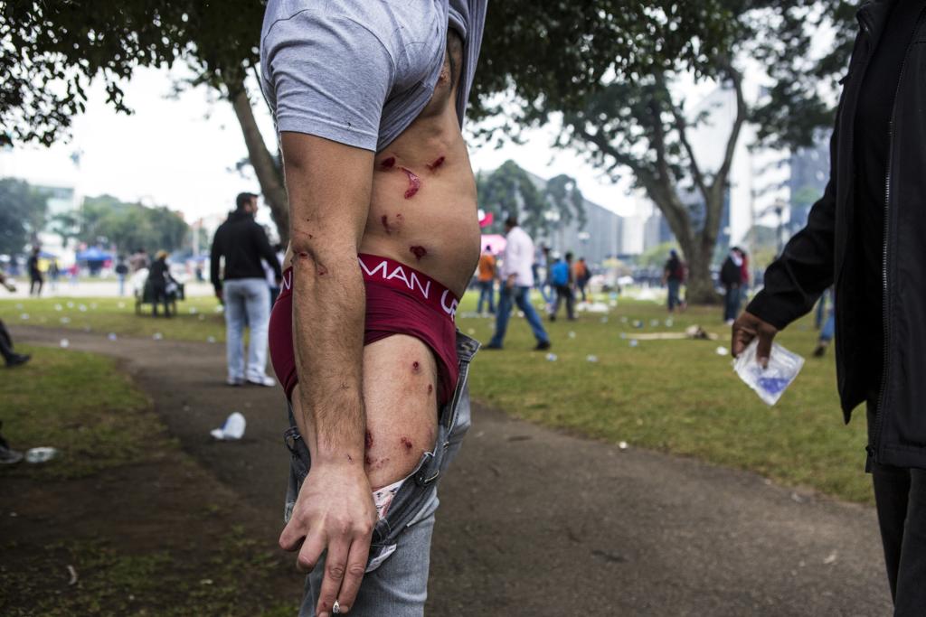 Manifestante mostra as marcas das balas de borracha: excesso. | Brunno Covello/Gazeta do Povo