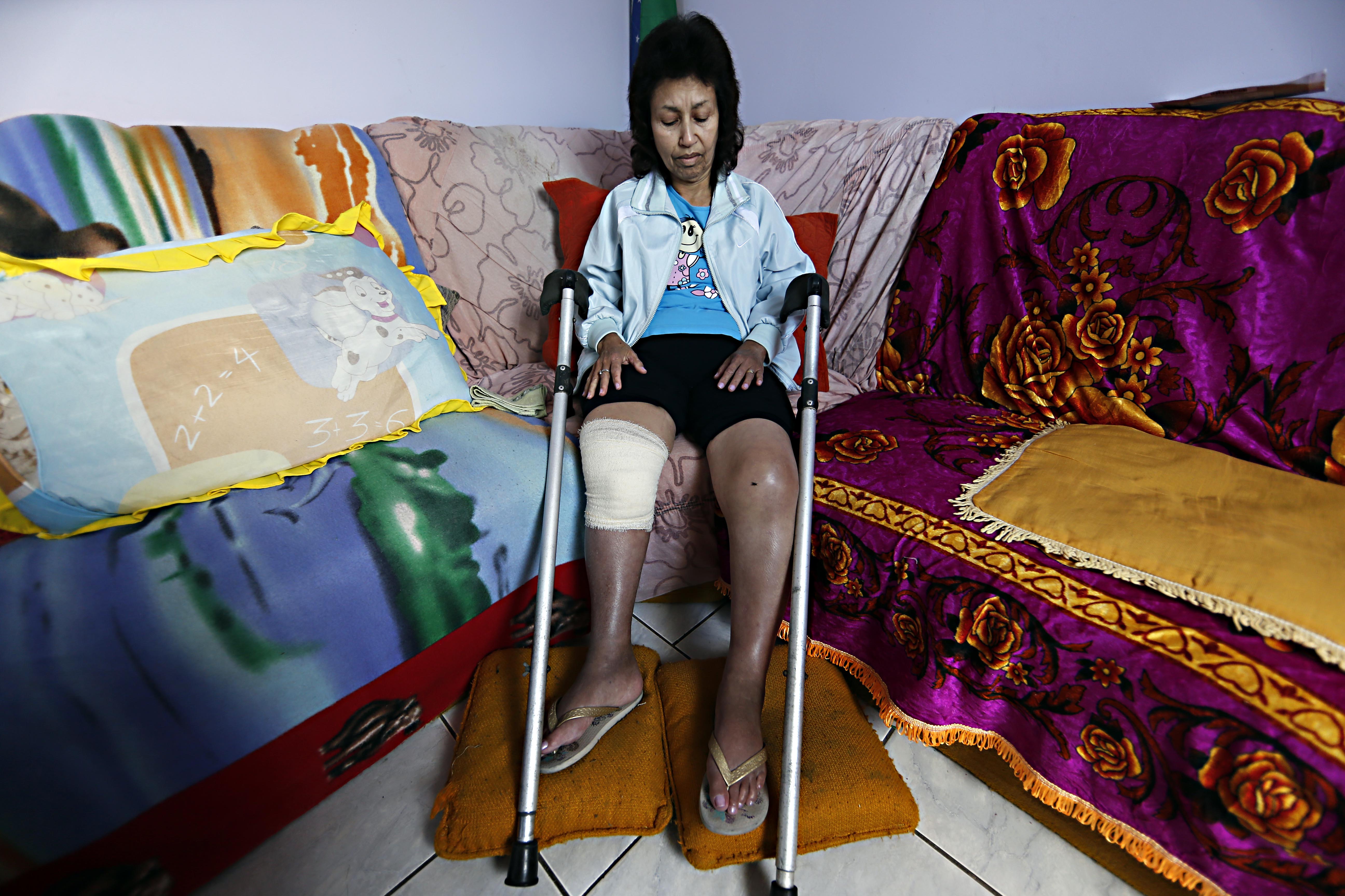 Zélia da Silva, 54 anos, vive rotina de dores e dificuldade de locomoção há oito anos. | Albari Rosa/Gazeta do Povo