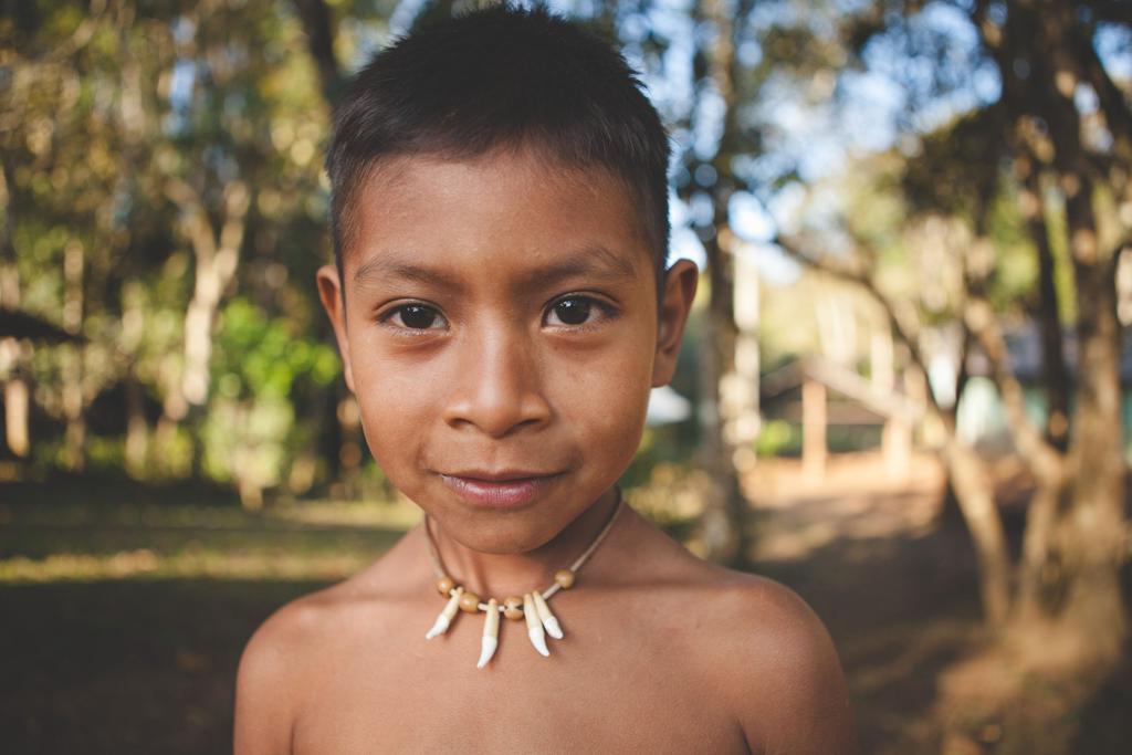 Exposição é fruto do trabalho do fotógrafo co, a ONG Transforme Sorrisos. | Bruno Santos/Divulgação