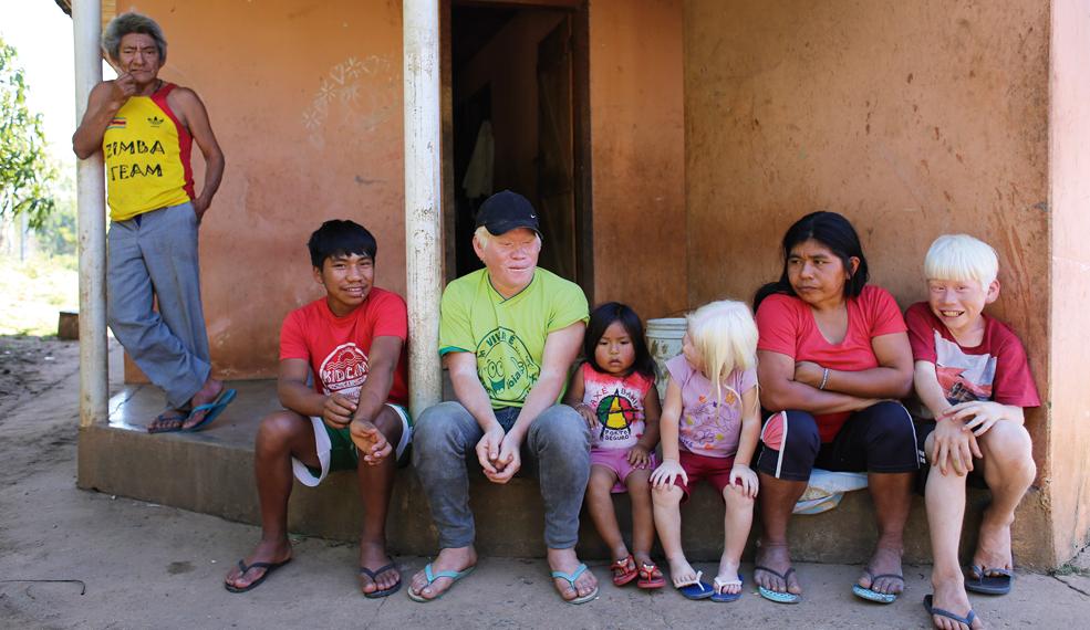 Ao lado do avô, da mãe e da vizinha Thayala, os três irmãos albinos da aldeia Faxinal, em Cândido de Abreu: Barreirito, Geane e Camilo. | Fotos: Daniel Castellano/Gazeta do Povo