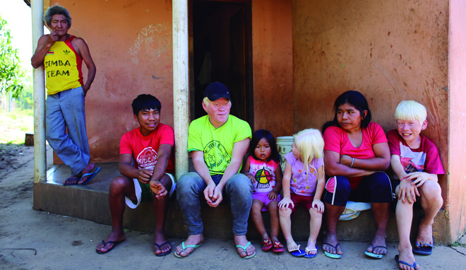 Ao lado do avô, da mãe e da vizinha Thayala, os três irmãos albinos da aldeia Faxinal, em Cândido de Abreu: Barreirito, Geane e Camilo. | Fotos: Daniel Castellano/Gazeta do Povo
