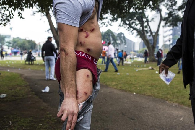 Balas de borracha e bombas feriram mais de 200 pessoas. | Brunno Covello/Arquivo/Gazeta do Povo