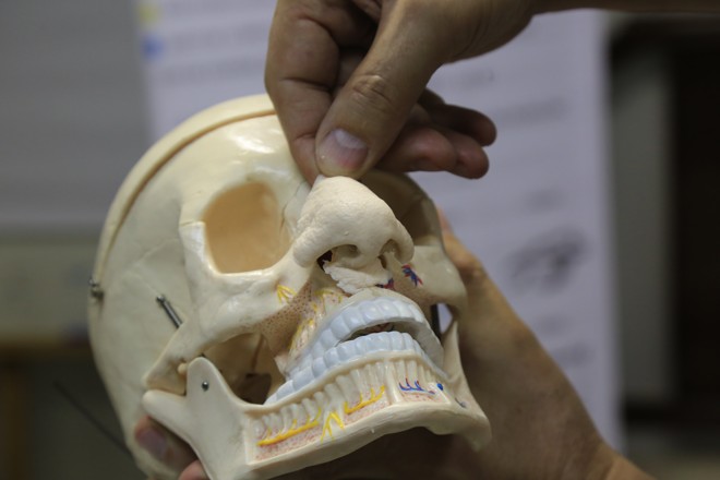 Quando um cadáver chega com o rosto deformado, os moldes são utilizados para a recomposição da face. | Ivonaldo Alexandre/Gazeta do Povo