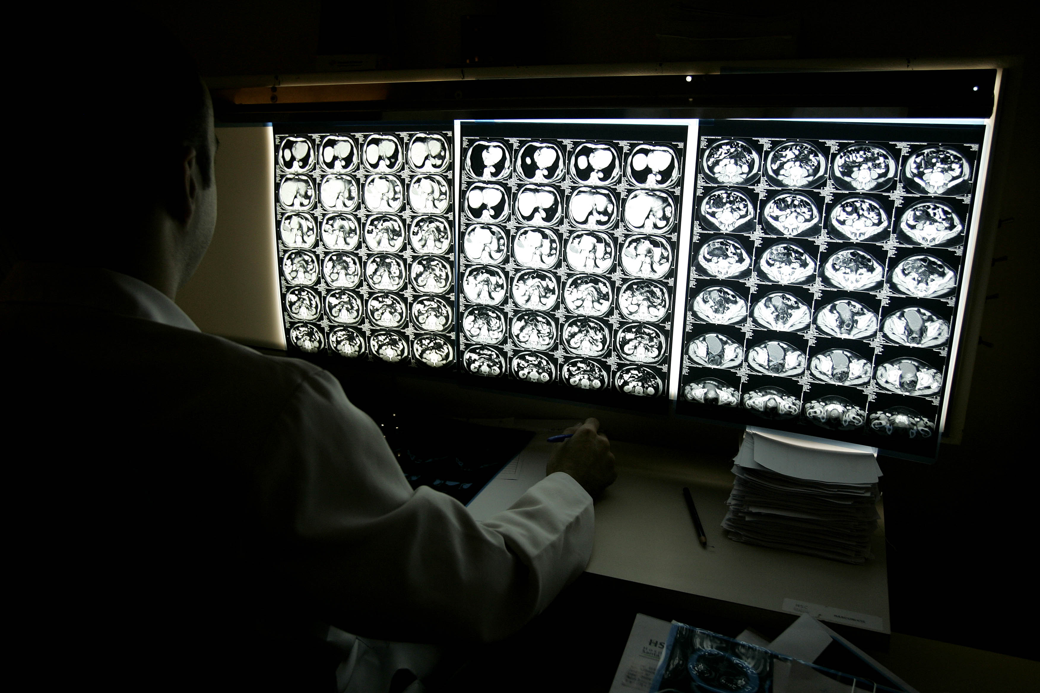 A ressonância é um dos exames usados para descobrir as sequelas do transtorno bipolar. | Jonathan Campos/Gazeta do Povo