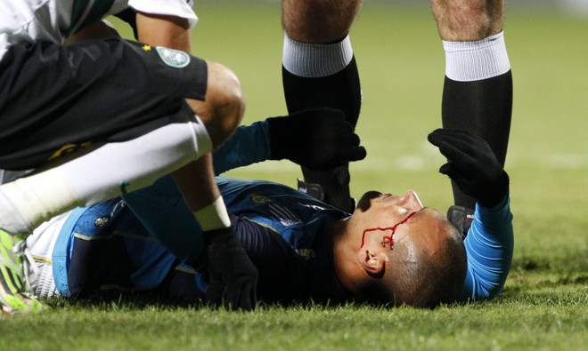 Goleiro do Avaí sangra no chão enquanto espera atendimento em uma partida contra o Coritiba, no Couto Pereira, pelo Campeonato Brasileiro. | Daniel Castellano/Gazeta do Povo