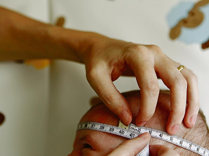 Em novembro, um surto de bebês com malformação irreversível do cérebro foi relacionado à contaminação das mães por zika vírus. | Antônio More/Gazeta do Povo