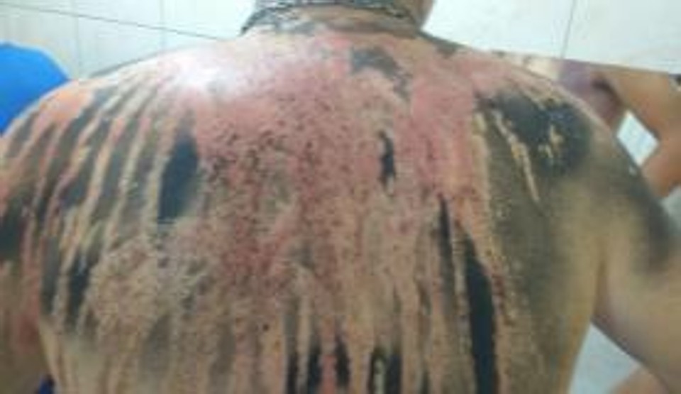 Calouro da Faculdade da Amazônia expõe a violência praticada por veteranos | Arquivo pessoal/