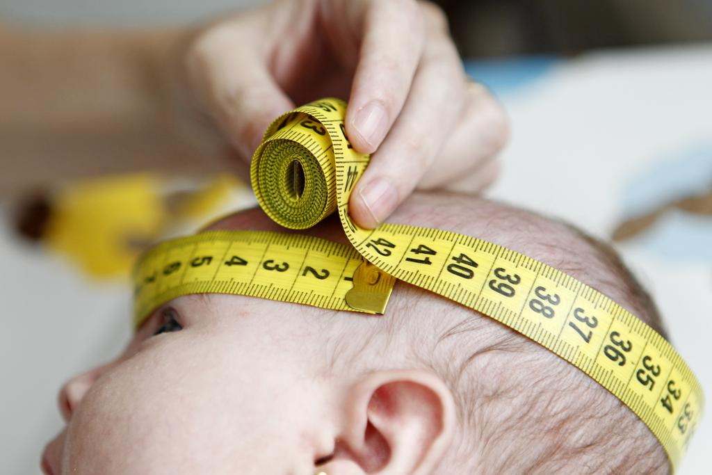 Mesmo quando perímetro cefálico é superior a 32 centímetros, bebês de mães infectadas com zika podem apresentar problemas importantes na estrutura do cérebro | Antônio More/Gazeta do Povo