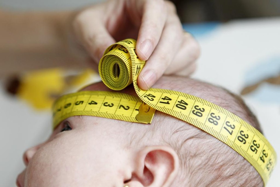 Mesmo quando perímetro cefálico é superior a 32 centímetros, bebês de mães infectadas com zika podem apresentar problemas importantes na estrutura do cérebro | Antônio More/Gazeta do Povo