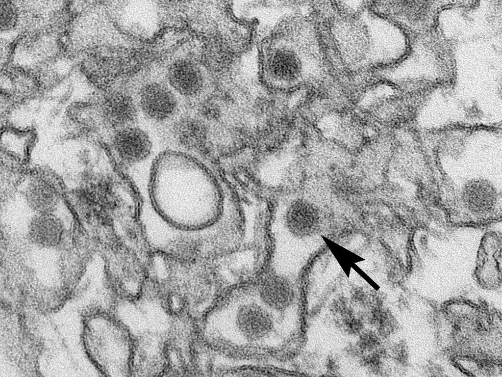 Imagem de microscópio eletrônico do vírus da zika (pontos pretos) em tecido humano. | Cynthia Goldsmith/CDC