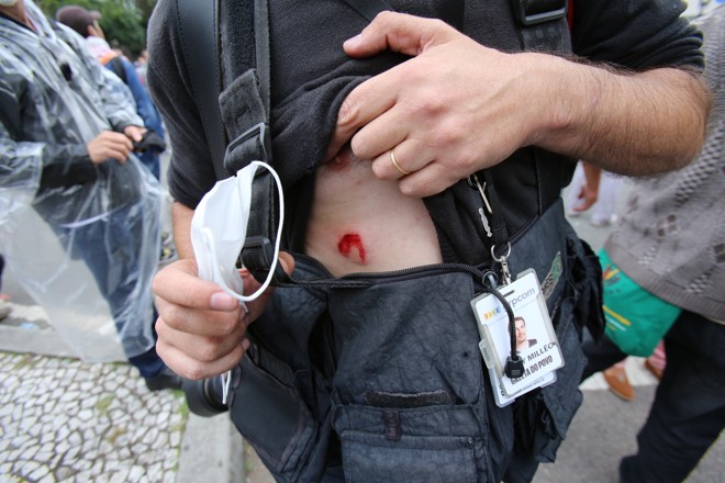 Repórter fotográfico da Gazeta do Povo foi atingido por um estilhaço. | 