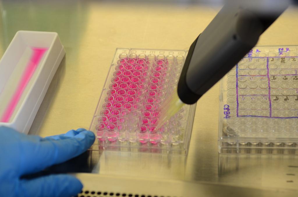 Estudos foram publicados recentemente, por meio de resultados obtidos em laboratório. | Rovena Rosa/Agência Brasil