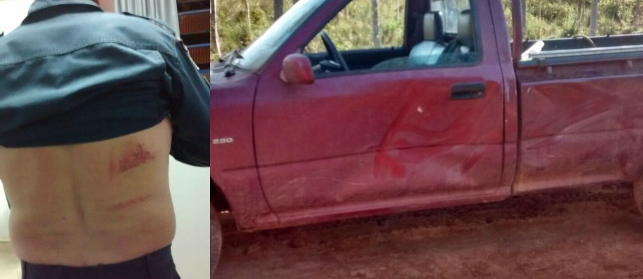 Policial ficou com marcas nas costas | Nilson Silva/ Arquivo Pessoal |PM/ Divulgação