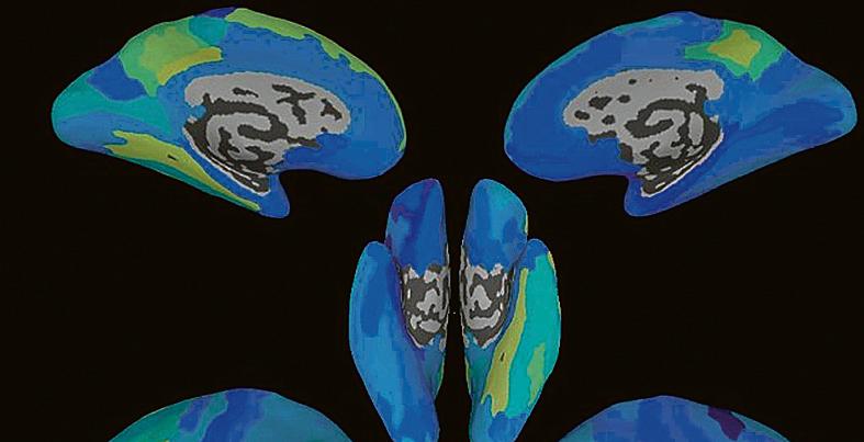 Mapeando o cérebro: tecnologia foi capaz de prever frases que seriam ditas a partir de análise do padrão neural de uma pessoa | Divulgação
/University of Rochester