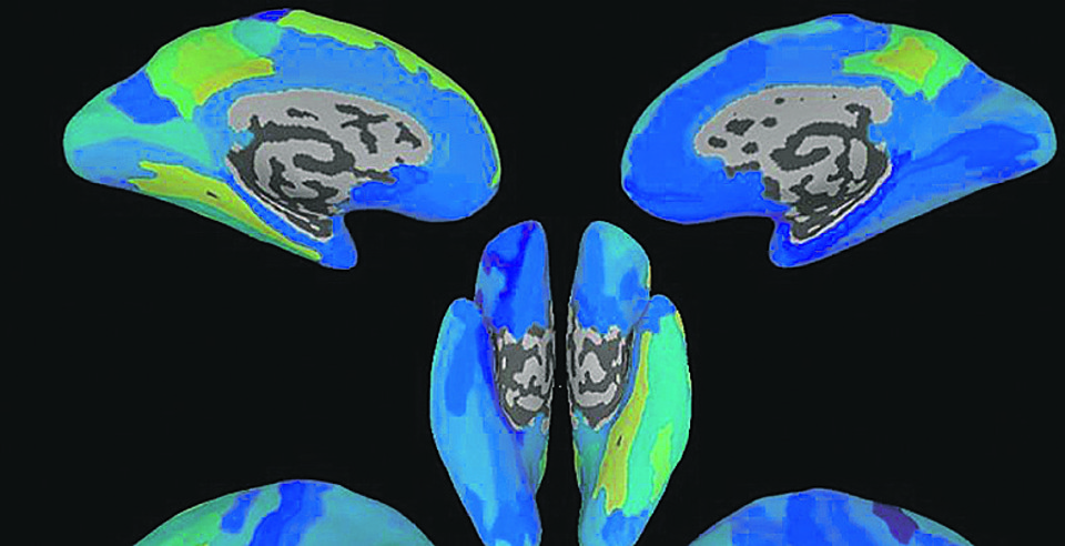 Mapeando o cérebro: tecnologia foi capaz de prever frases que seriam ditas a partir de análise do padrão neural de uma pessoa | Divulgação
/University of Rochester