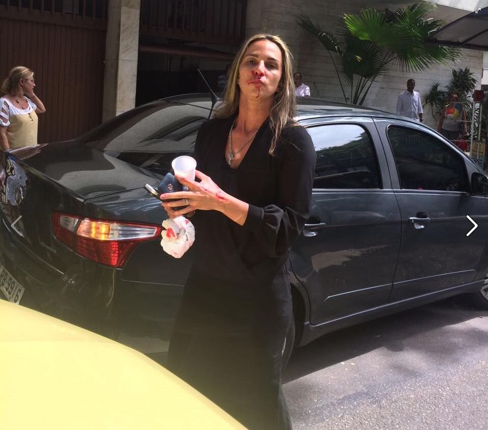 Luciana Severo fez um desabafo sobre a agressão em seu perfil no Facebook | Reprodução/Facebook