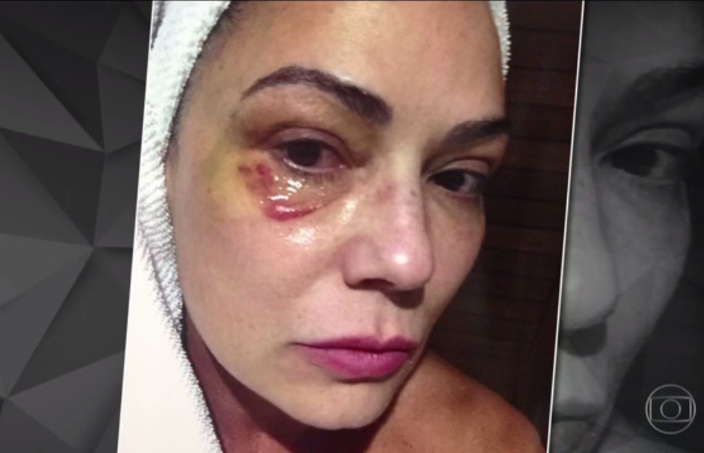 | Reprodução/Fantástico/