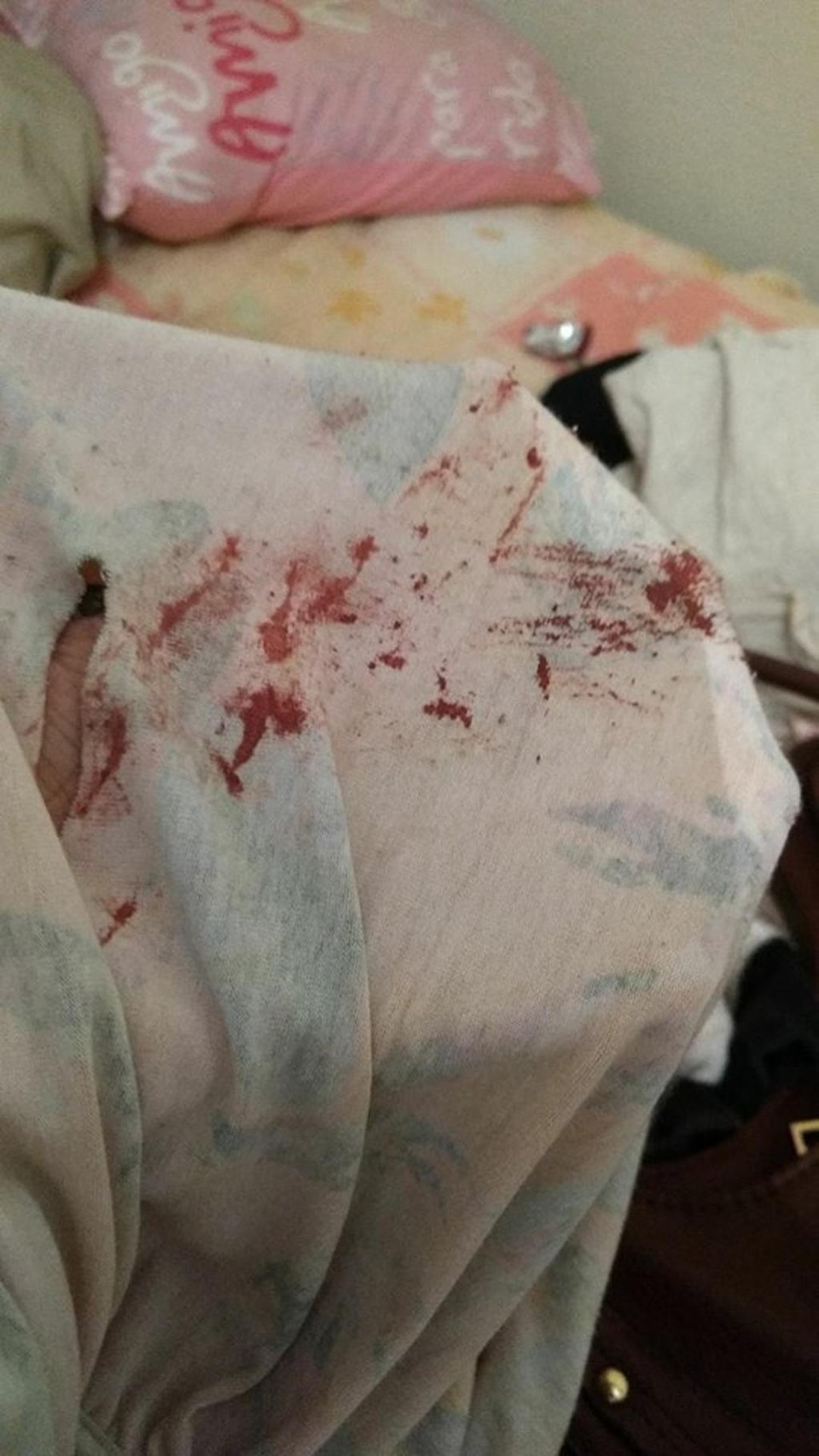Foito de vestido ensaguentado foi postada pela vítima em sua conta pessoal no Facebook | Divulgação/Jhenifer Inácio