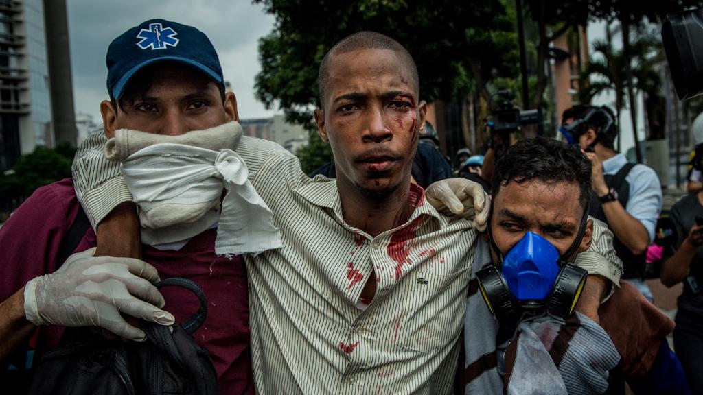 Paramédicos atendem manifestante de oposição em Caracas: mortos já passaram de duas dezenas nas últimas semanas | Meridith Kohut/NYT
