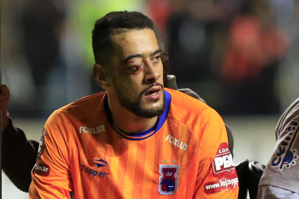 Goleiro Léo se chocou com Fred no lance do segundo gol do Atlético-MG | DANIEL TEOBALDO/ESTADÃO CONTEÚDO