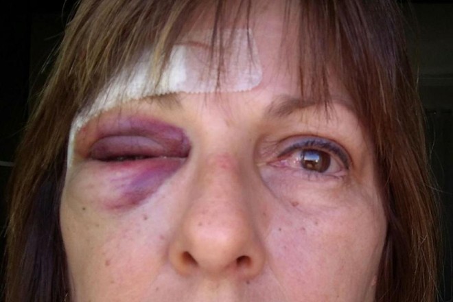 Marcia Friggi: recuperação após socos em escola | Reprodução / Facebook
