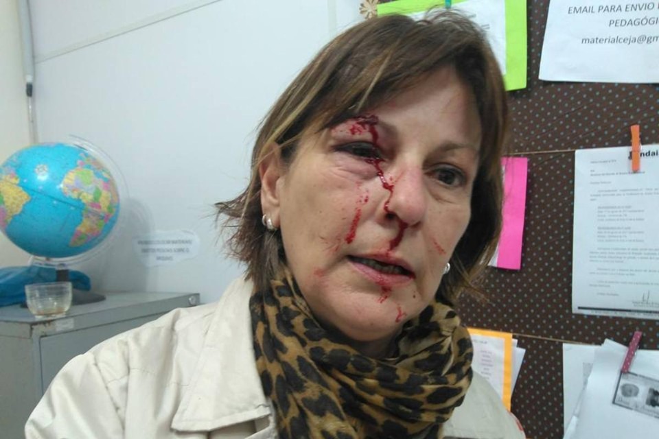 Promotora: aluno que agrediu professora é reincidente e deve ter punição Marcia Friggi: hematoma e corte no rosto após agressão | Reprodução/Facebook