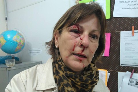 Promotora: aluno que agrediu professora é reincidente e deve ter punição Marcia Friggi: hematoma e corte no rosto após agressão | Reprodução/Facebook