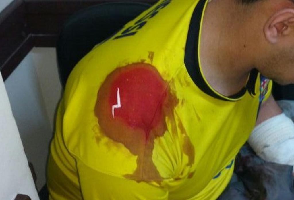 Enquanto era atendido da facada que levou no ônibus, o cobrador Jhonatan Martins Alberti teve o carro do primo furtado no Hospital Evangélico. | /