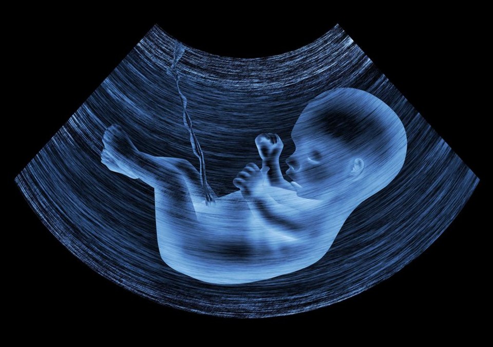 Reação pró-vida: PSOL faz “aborto jurídico” e manobra no STF | Bigstock
