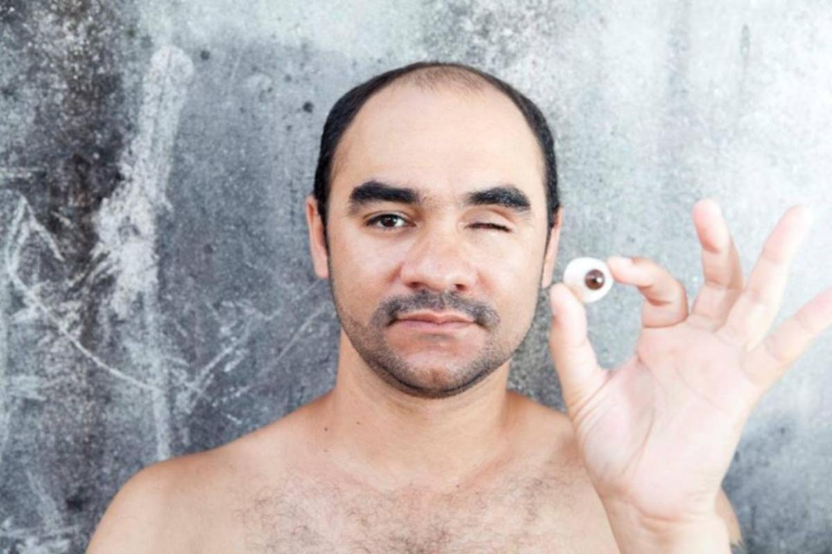 Fotógrafo Sérgio Silva foi atingido por bala de borracha em junho de 2013 e perdeu o olho esquerdo em decorrência do acidente | Facebook Sérgio Silva/
Arquivo pessoal