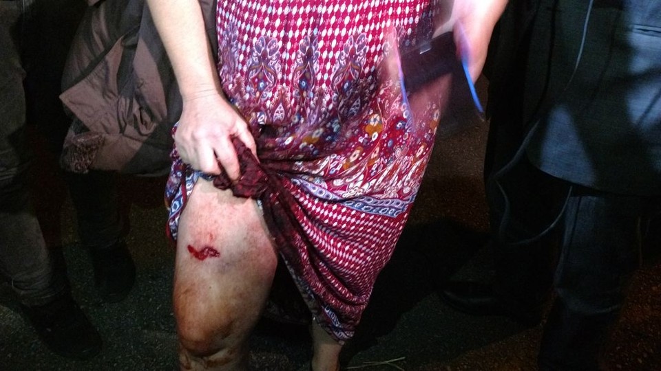 Confronto entre Polícia Federal e manifestantes pró-Lula deixa feridos em Curitiba Professora foi ferida na perna por um tiro de bala de borracha. | Durval Ramos/Gazeta do Povo