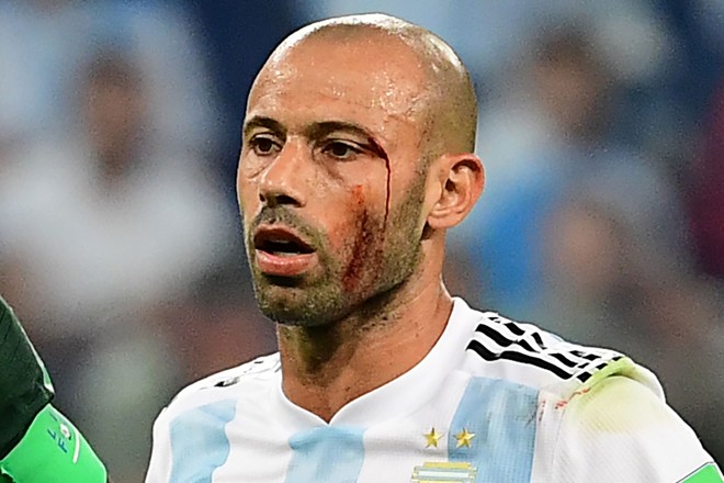  | GIUSEPPE CACACE/AFP