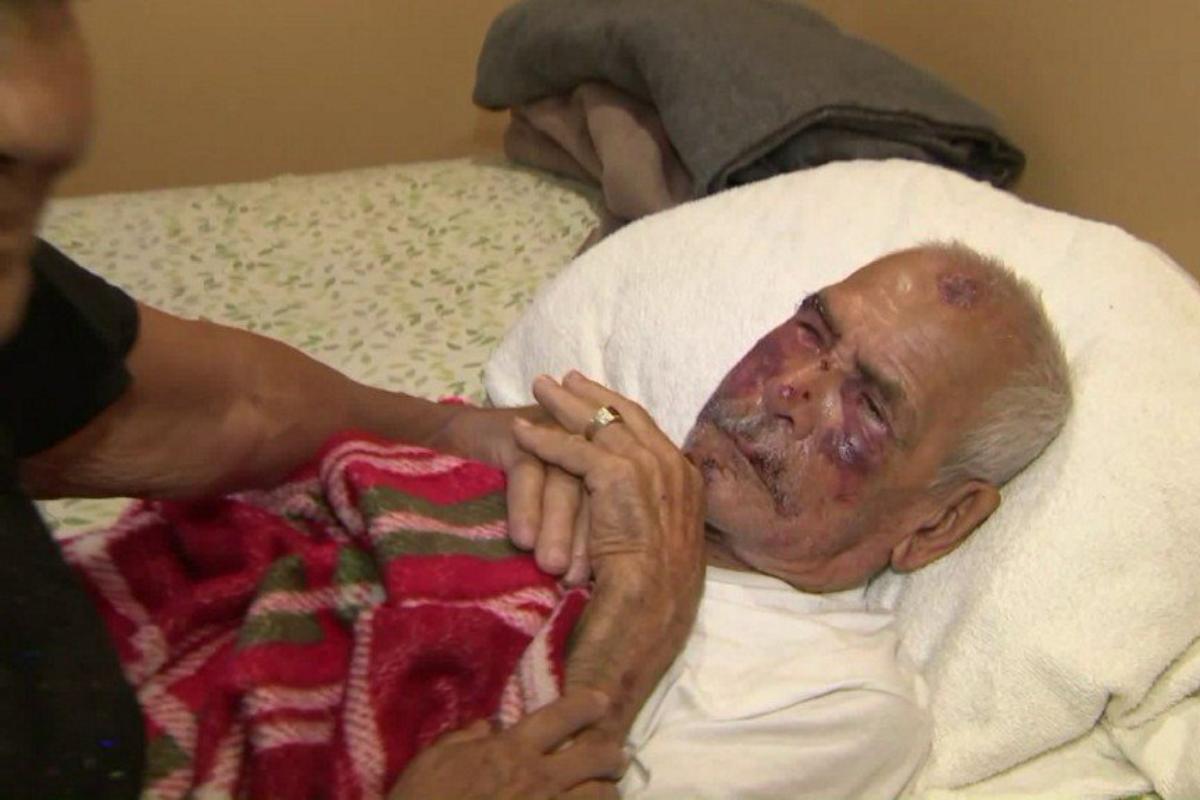 Rodolfo Rodriguez, vítima do ataque em subúrbio de Los Angeles, já teve alta. Uma vaquinha online vai custear sua recuperação | Reprodução/Twitter KTLA