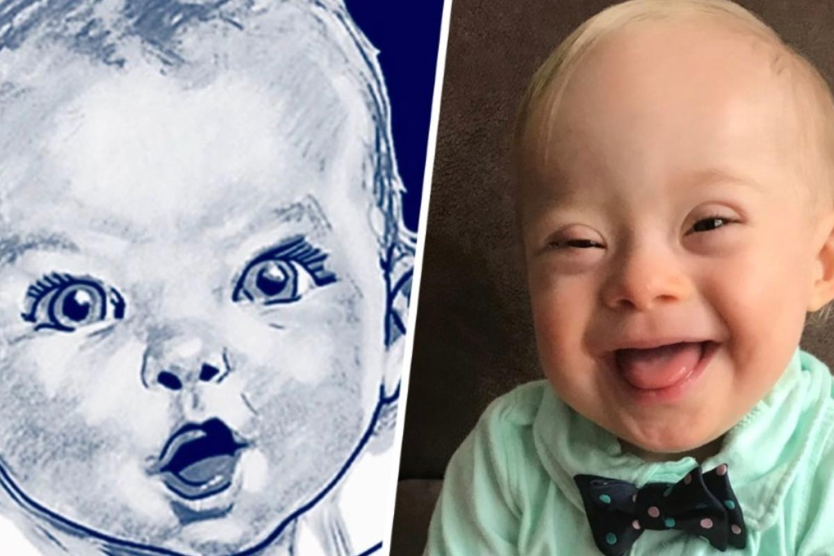 Lucas, o garoto-propaganda de 2018 da Gerber, marca norte-americana de produtos para bebê. | Reprodução/
Gerber Baby