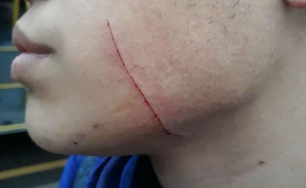 Ferimento à faca em passageiro foi superficial. | Colaboração/