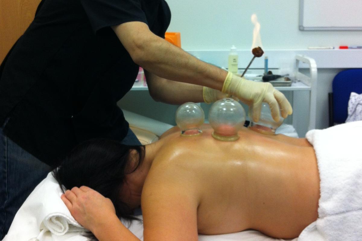 A “ventosaterapia” é um dos tratamentos da medicina tradicional chinesa sobre o qual não existem evidências científicas sólidas para referendá-lo | Pixabay