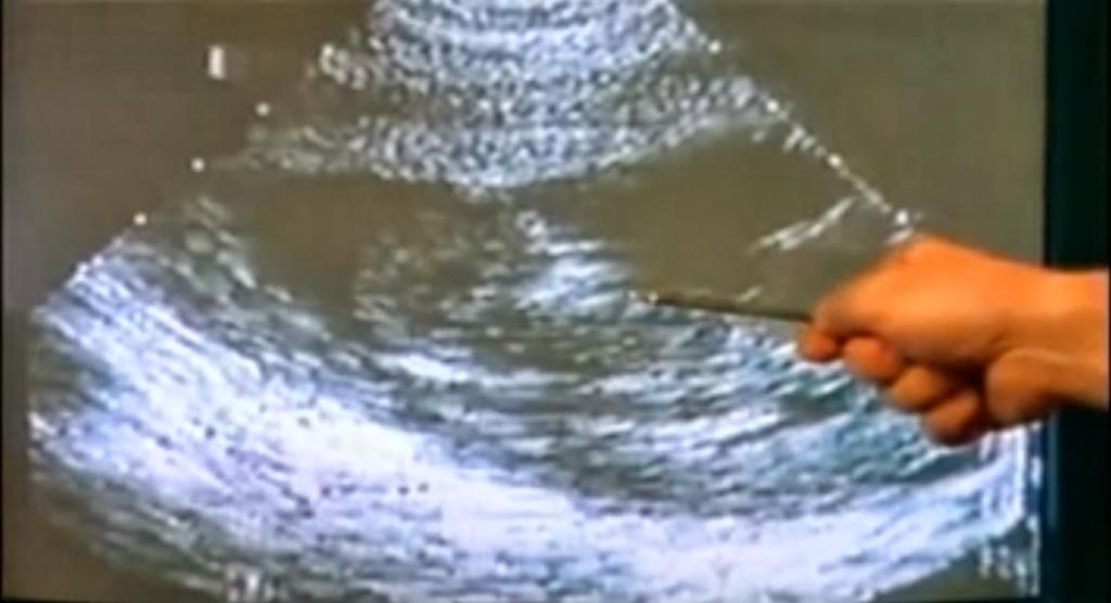 Imagem do vídeo “O Grito Silencioso” exibido para estudantes de 13 anos | Reprodução /YouTube