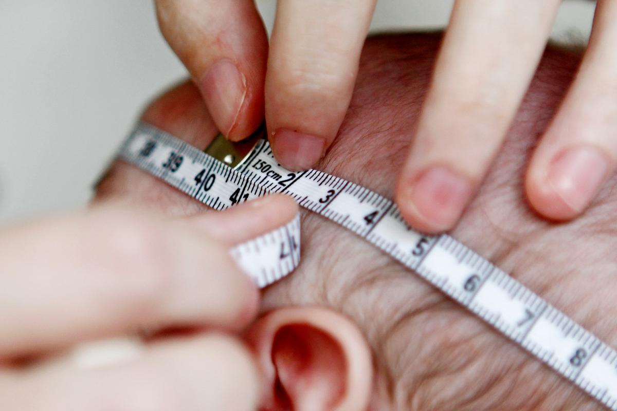 Bebê com 23 dias de vida tem sua cabeça medida com fita métrica. O procedimento faz parte de exame para detectar a microcefalia. Grávidas infectadas com o zika vírus podem ter bebês com a condição. | Antônio More/Gazeta do Povo/Arquivo