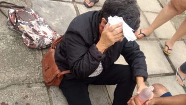 Aposentada Mari Salet Ferreira levou mais de 20 pontos no rosto e terá de passar por cirurgia após ataque de um rotweiller e um pit bull no bairro Atuba. Foto: PM