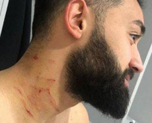 Ferhat Yazgan, do Sakaryaspor, mostra os ferimentos com lâmina. | /Reprodução Instagram
