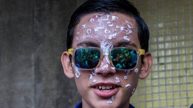Rufo Chacón, adolescente de 16 anos que ficou cego após ser atingido por balas de borracha em Táriba, Venezuela